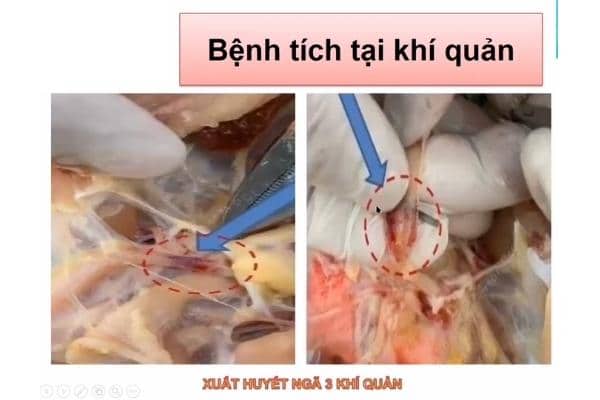 Bệnh tích tại khí quản